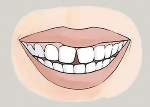 <a href=http://bitarticles.com/news_article?news_id=116>一次性口腔探針</a>